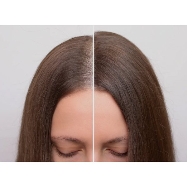 Bioactive Hair Treatment - Action Shampoo Anti Caduta