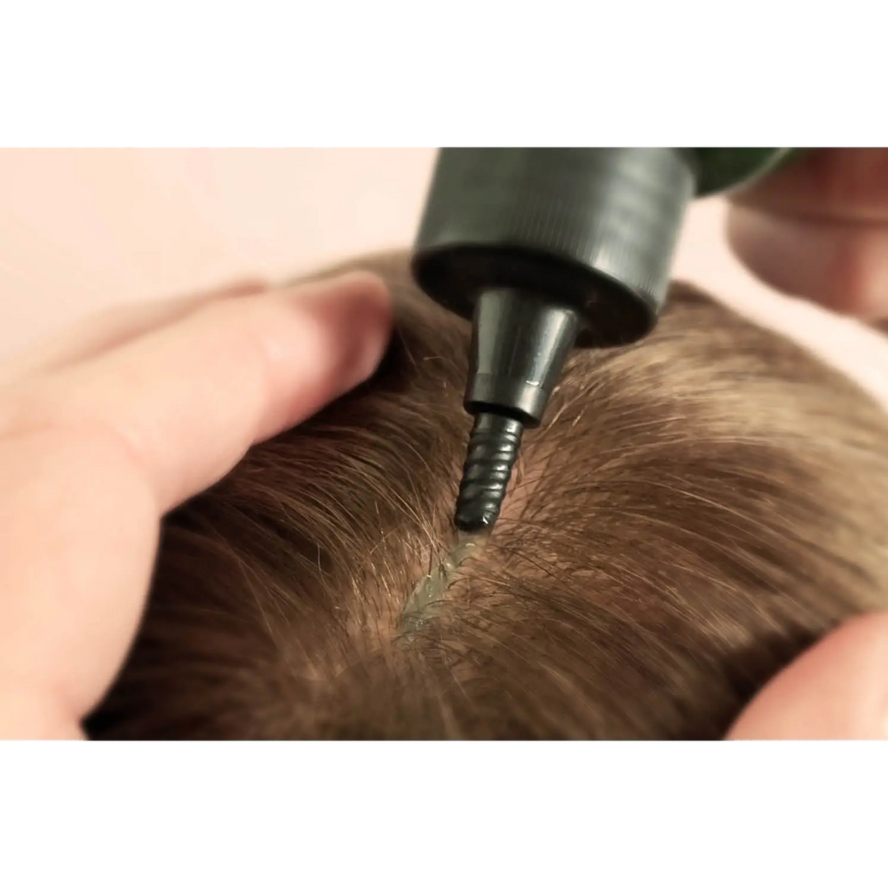 Emulsione Peel Deforforante